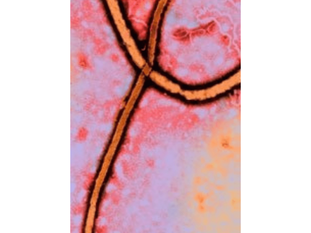 Ebola